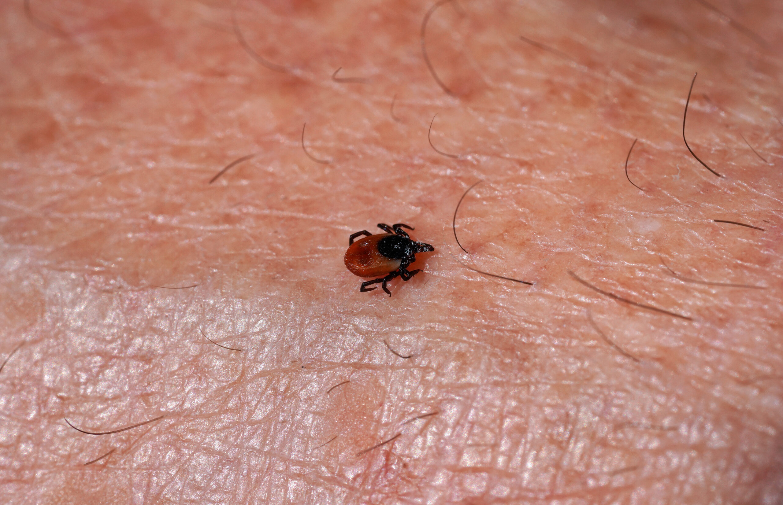 Small tick crawling on human skin.